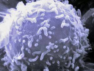 This is a t-cell.  My MS resides within my t-cells.  That is why we kill them with chemo.